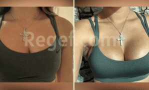 Why Do All Boob Jobs Look So Bad Get It Right why-do-all-boob-jobs-look-so-bad-get-it-right